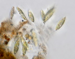 gomphonema___sp.