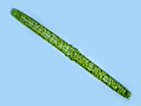 pleurotaenium_truncatum2b