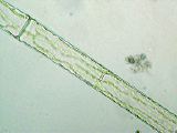 spirogyra_4