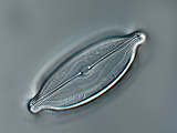 surirella_sp.