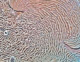 coral14035