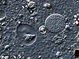 acanthocystis__sp.2l