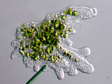 acanthocystis__sp.2l