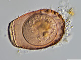 acanthocystis__sp.2l