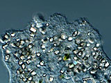 acanthocystis__sp.2l